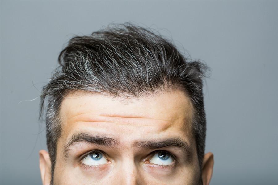 Going Grey in Your 20s: What Does it Mean?